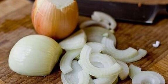 Cebolla